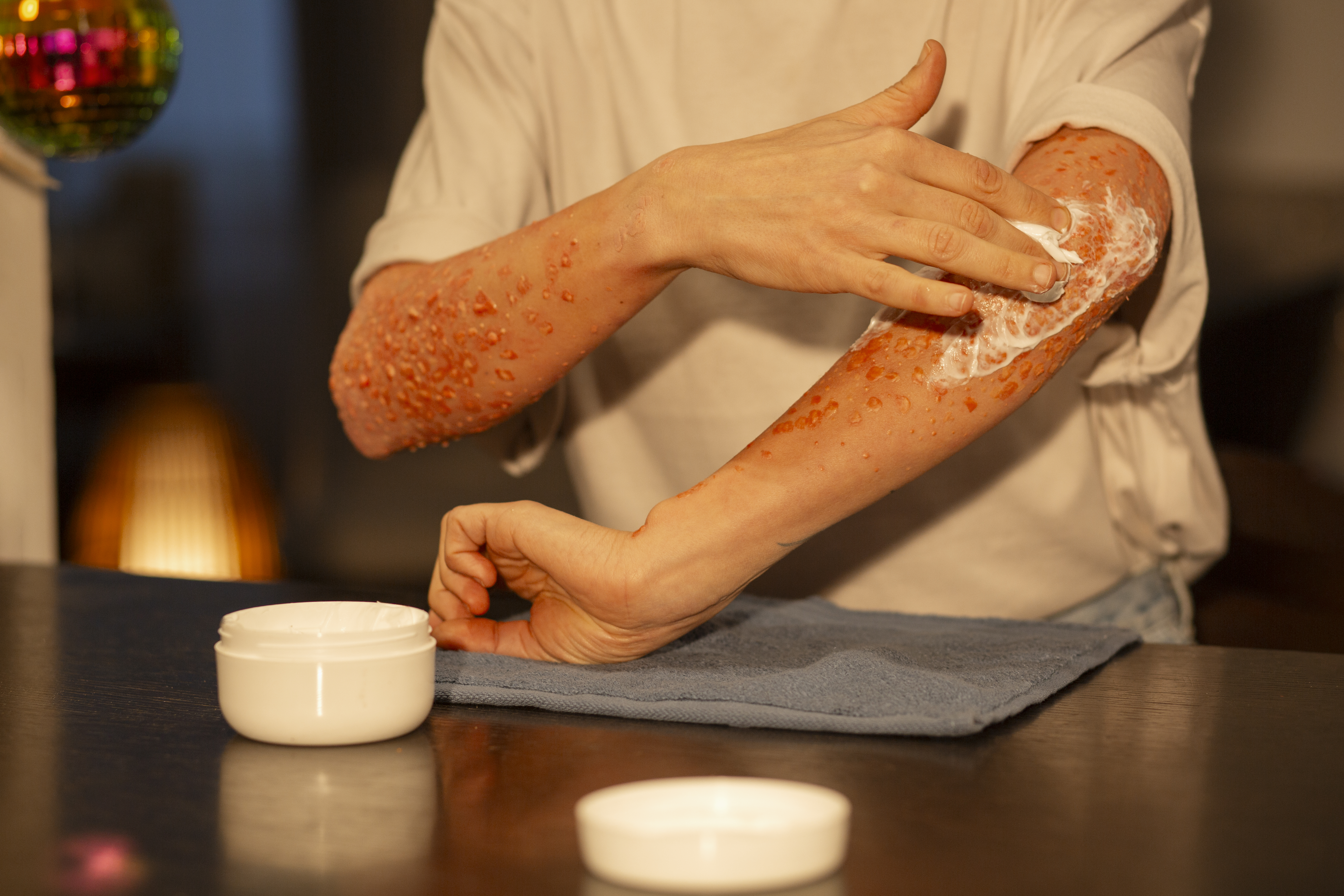 pacient having red spots